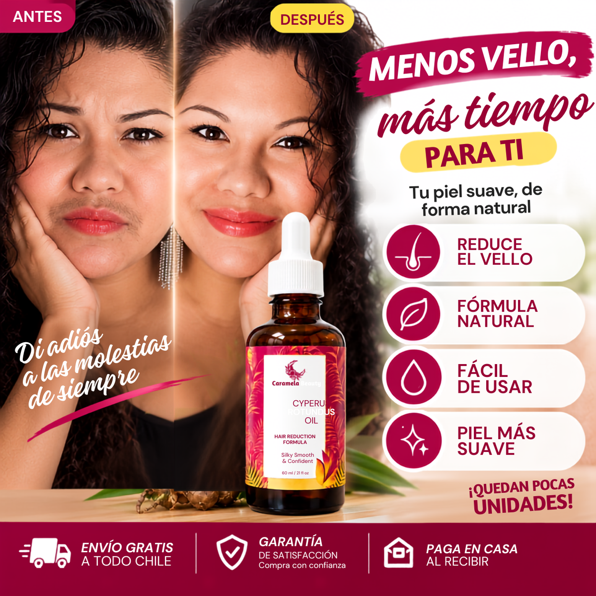 Cyperus Rotundus ™ Aceite de reducción progresiva del vello