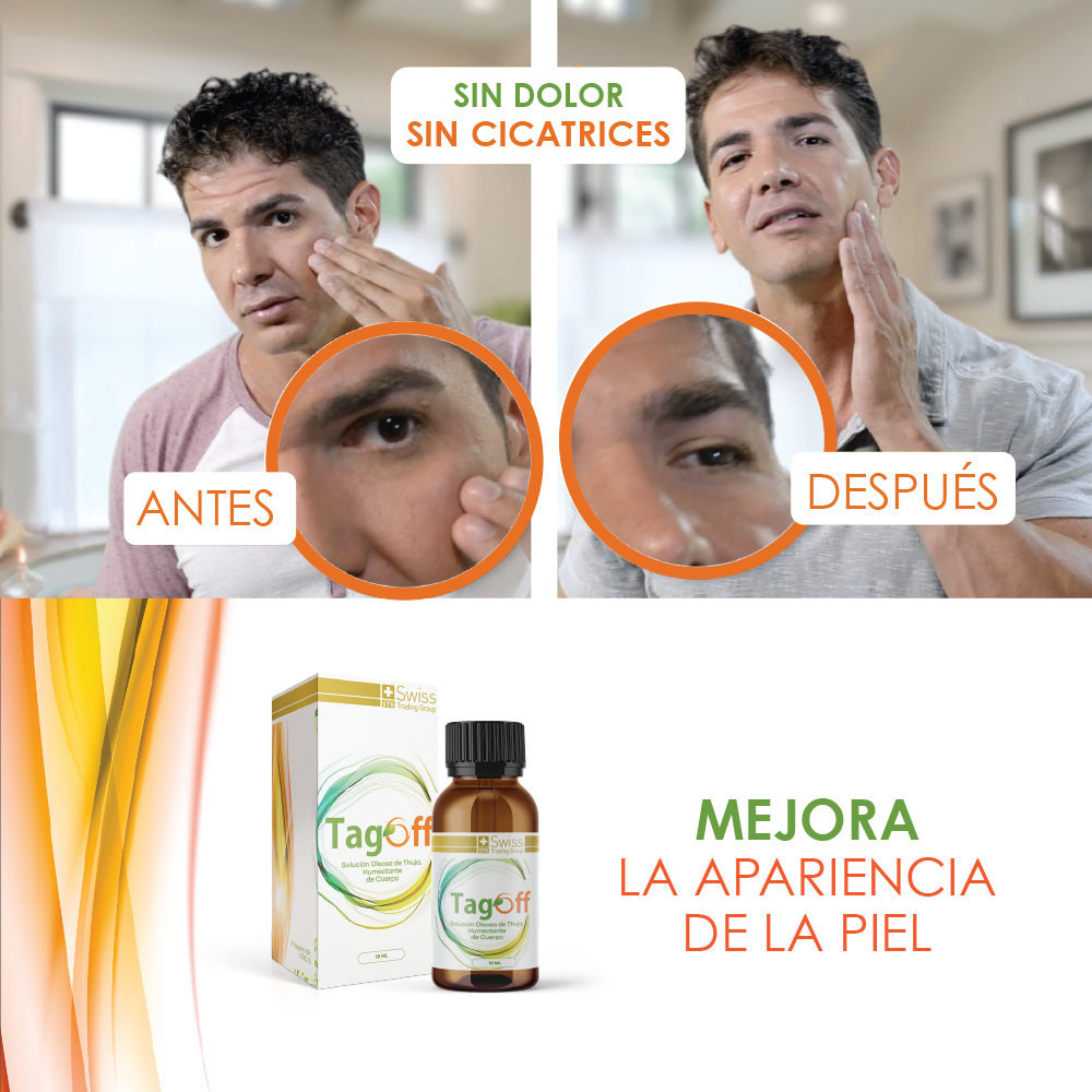 Tag Off Elimina Verrugas - Despídete de las verrugas y recupera tu seguridad personal