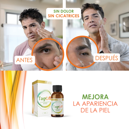 Tag Off Elimina Verrugas - Despídete de las verrugas y recupera tu seguridad personal